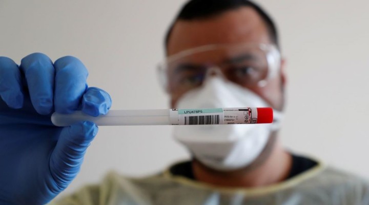 A member of the medical staff shows a used sample container at a test centre for coronavirus disease (COVID-19) at Havelhoehe community hospital in Berlin, Germany, April 6, 2020. REUTERS/Fabrizio Bensch - RC23ZF9TJ9A1